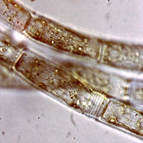 Oedogonium capillare vista al microscopio