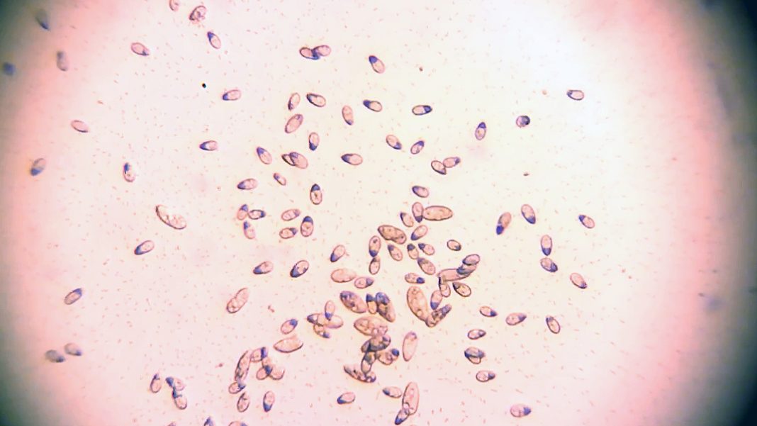 Tetrahymena (La malattia dei Guppy)